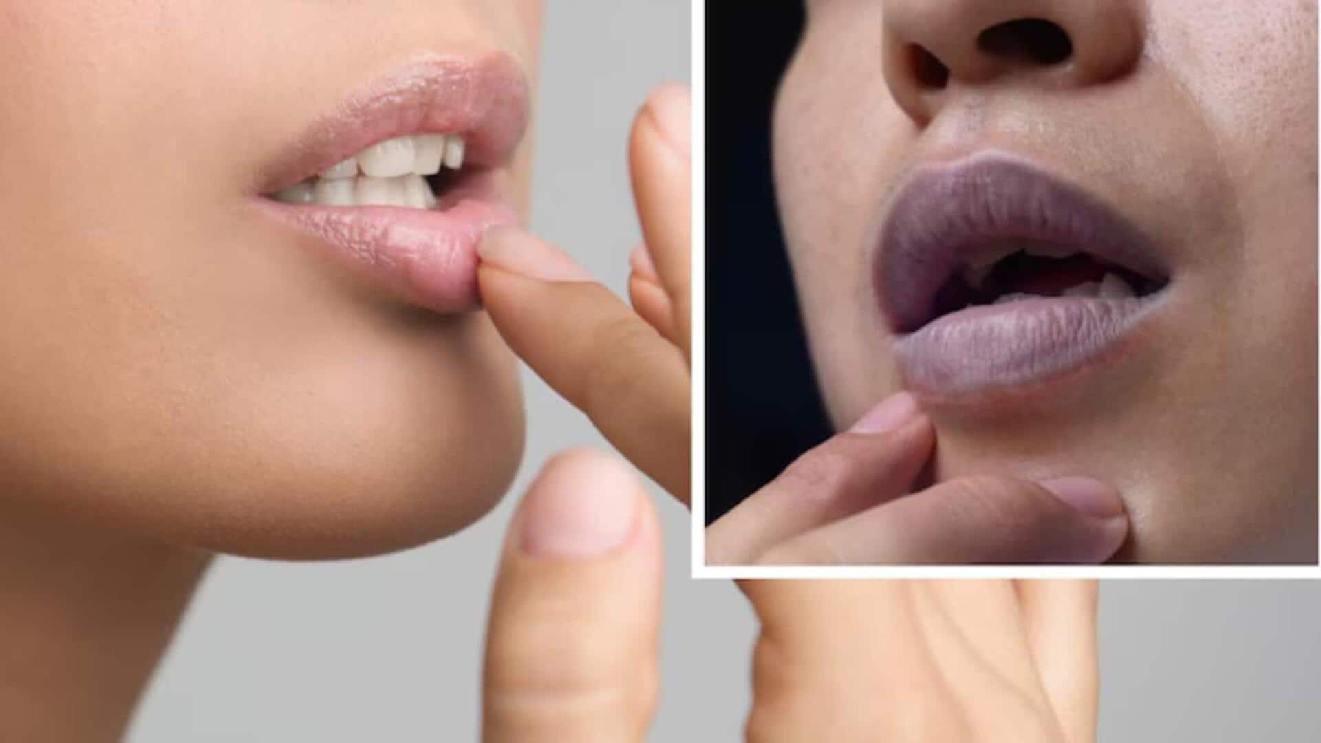 Skin Care Tips: పెదవులు పొడిబారడం తీవ్రమైన సమస్య కావచ్చు.. కారణాలు తెలుసుకోండిలా..