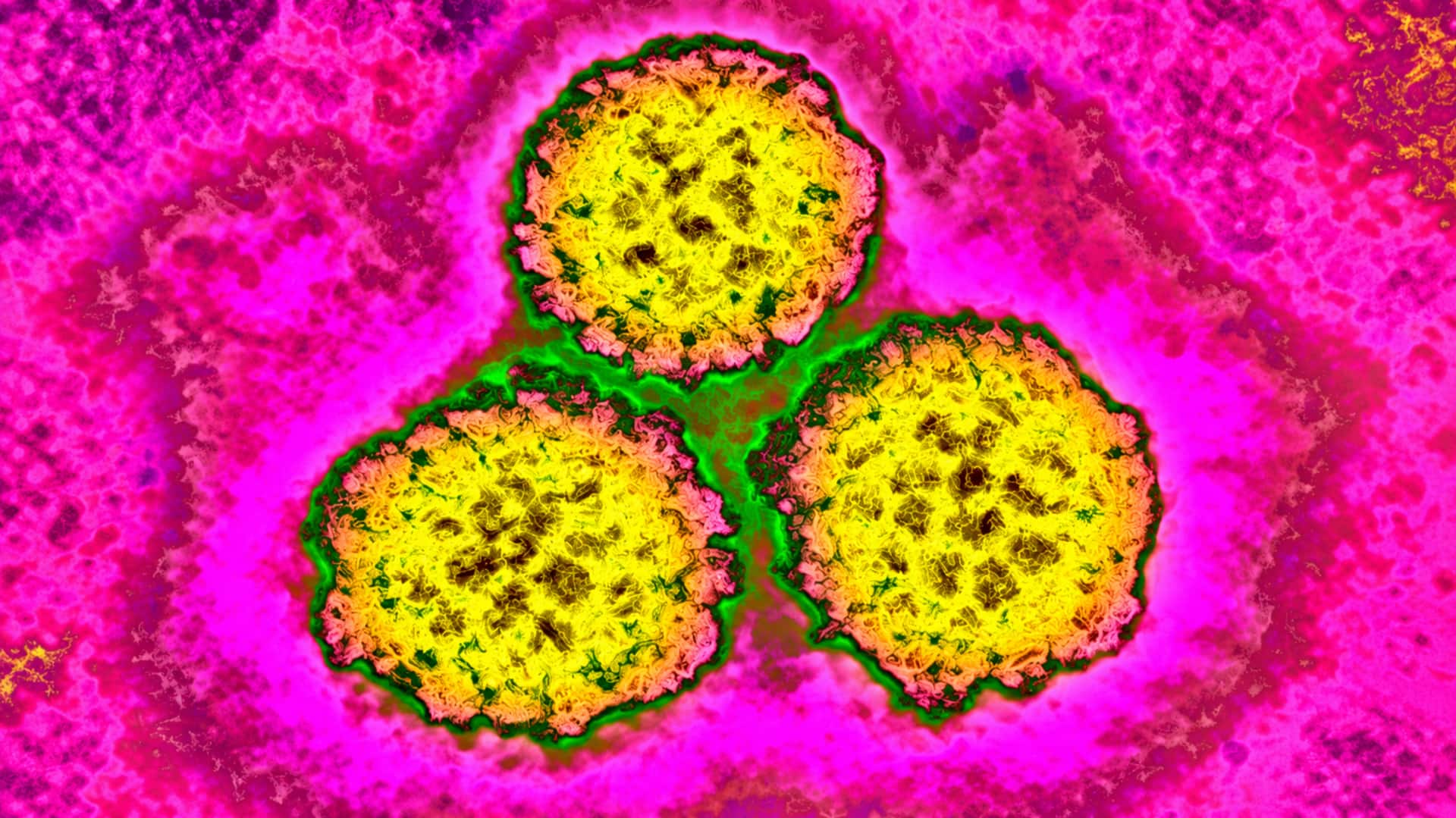 Cancer: క్యాన్సర్‌కు కారణమవుతున్న ఇన్ఫెక్షన్లు.. చాలా వరకు నివారించొచ్చట!
