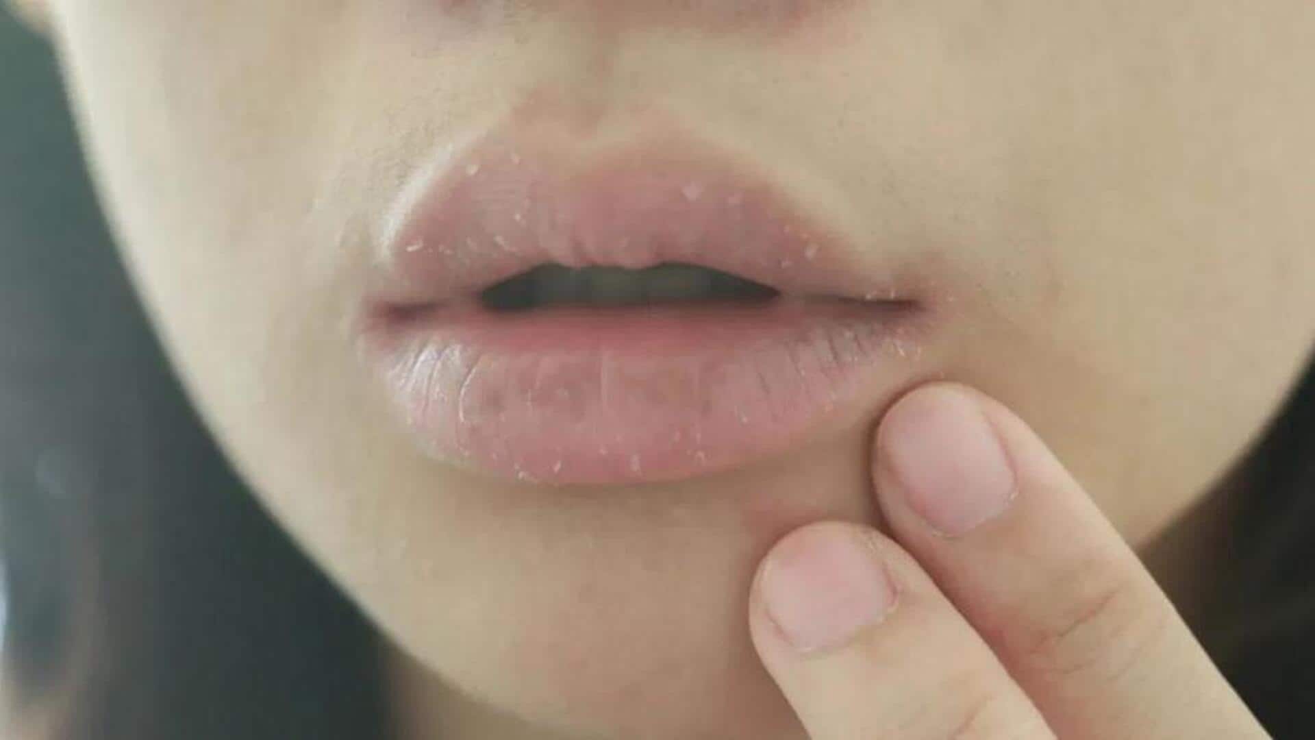 Winter 2025: చలికాలంలో పెదవులు తరచూ పగిలిపోతున్నాయా? దీని వెనుక ఉన్న అసలు కారణం ఇదే! 