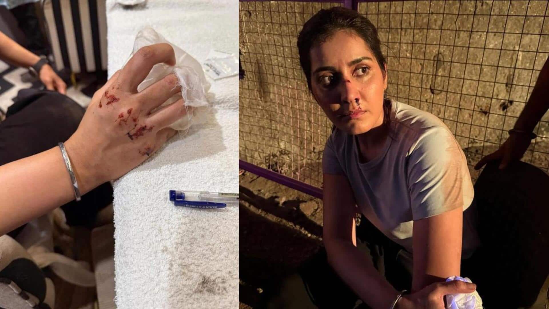 Raashii Khanna: టాలీవుడ్ స్టార్ హీరోయిన్ కు ప్రమాదం.. ముక్కు నుంచి రక్తం.. చేతులకు గాయాలు.. Raashii Khanna: టాలీవుడ్ స్టార్ హీరోయిన్ కు ప్రమాదం.. ముక్కు నుంచి రక్తం.. చేతులకు గాయాలు..