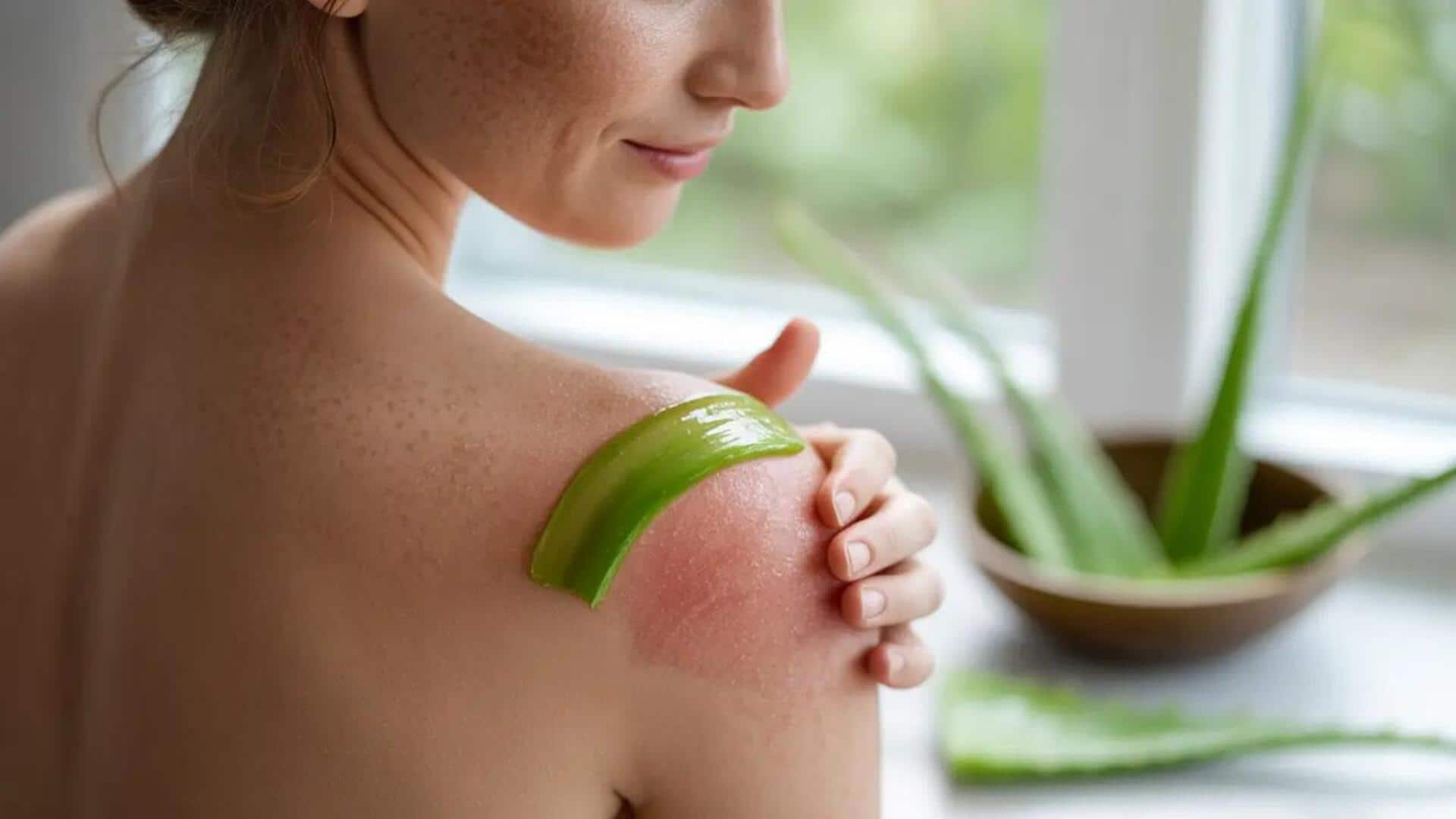 Sunburn Relief: ఎండ దెబ్బ తగ్గాలంటే ఇవే బెస్ట్ హోం రెమిడీస్