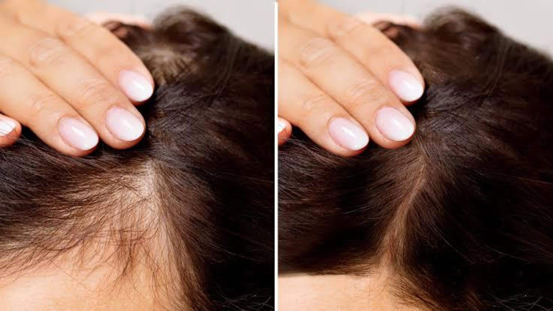 Hair Care Tips: జుట్టు పలుచగా ఉందా? ఈ 5 నేచురల్ హెయిర్‌స్టైల్స్ మీ లుక్‌ను మార్చేస్తాయి!
