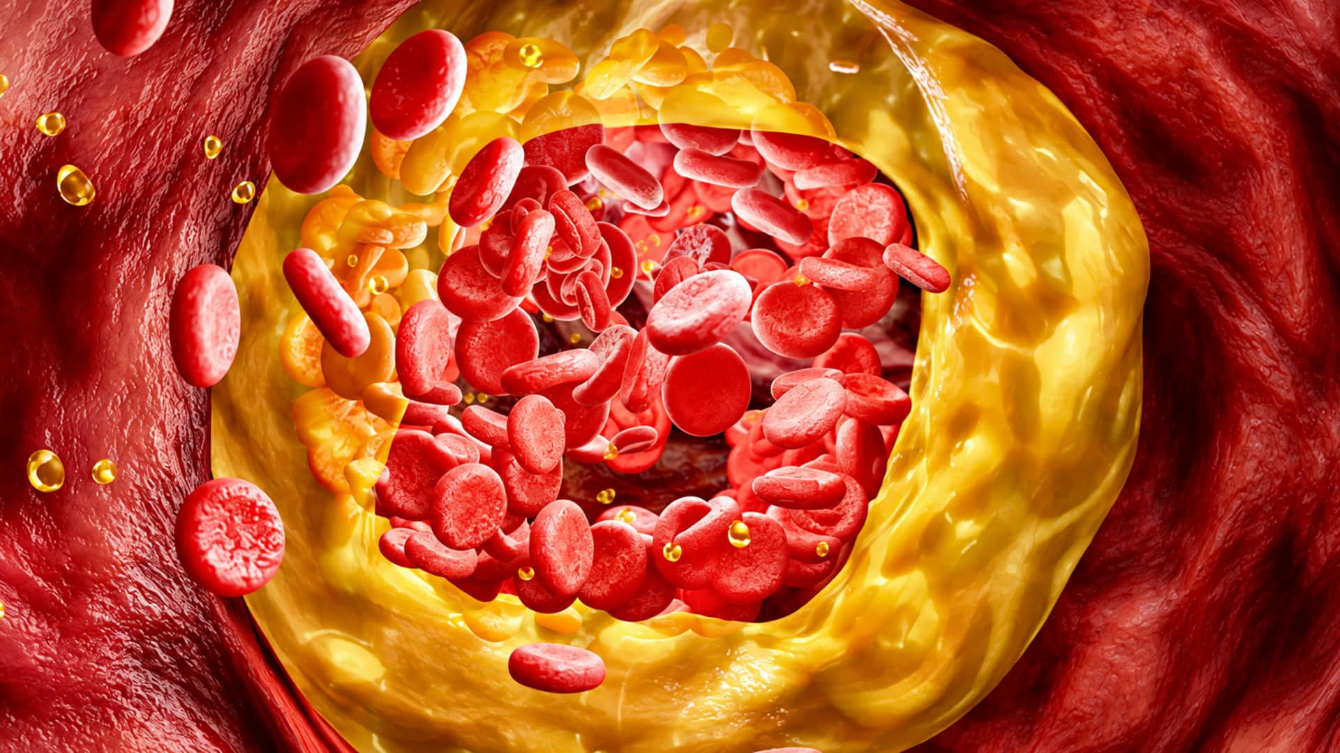 Bad Cholesterol: ఒక్క డోస్‌తో 52 శాతం తగ్గిన చెడు కొవ్వు.. కొత్త జన్యు చికిత్సపై ఆశలు