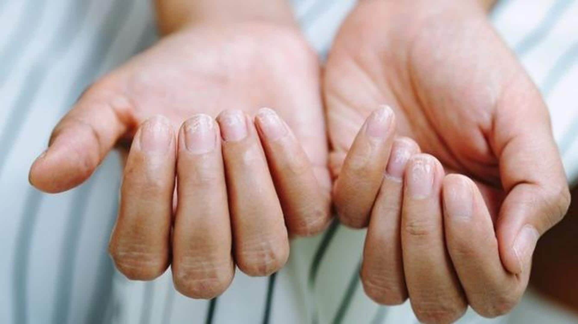 การดูแลหนังศีรษะทุกวันเพื่อเสริมความแข็งแรงของเล็บ