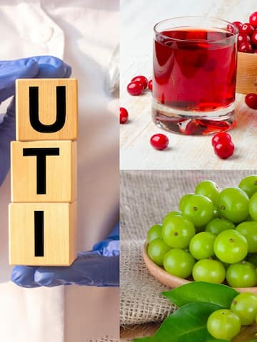 5 natural home remedies for UTI