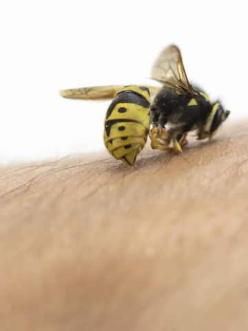 5 home remedies for insect bites