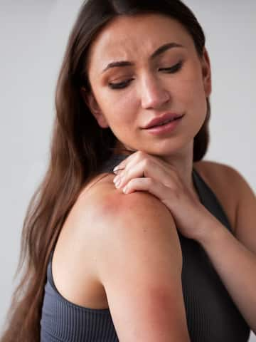 5 home remedies for itchy skin