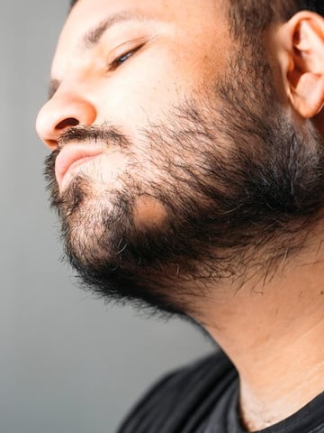 Home remedies for bald patches in beard