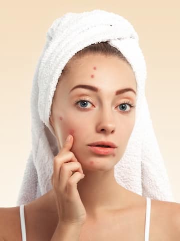 Sleeping mistakes that can trigger acne